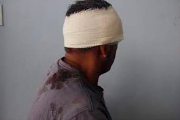 Morador de rua é roubado e agredido na cabeça nesta madrugada em Cáceres