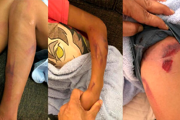 Pai que torturava e agredia o filho morre baleado pela PM durante ação