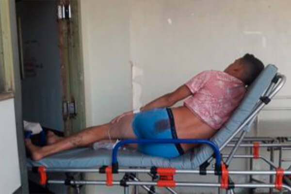 Homem leva tiro nas nádegas e só percebe horas depois