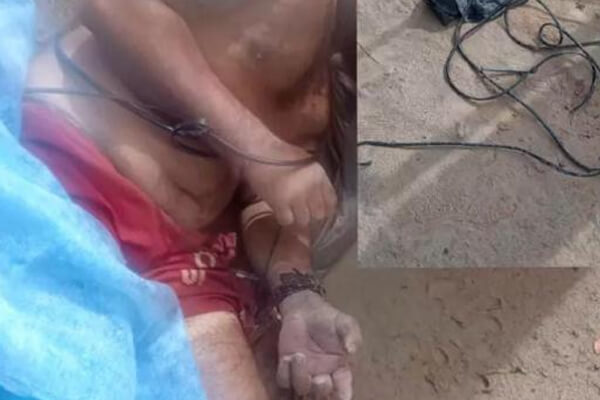 Acusado-de-ser-membro-de-facção-homem-é-torturado-e-baleado-no-rosto