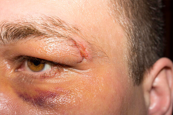 Homem arrasta esposa grávida pelos cabelos e leva surra da sogra