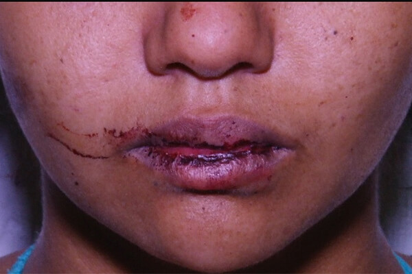 Bandidos-cortam-a-língua-de-adolescente-por-namorar-membro-de-facção-rival