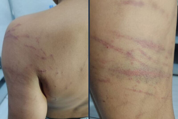 Mãe-é-presa-por-espancar-filho-de-9-anos-em-MT