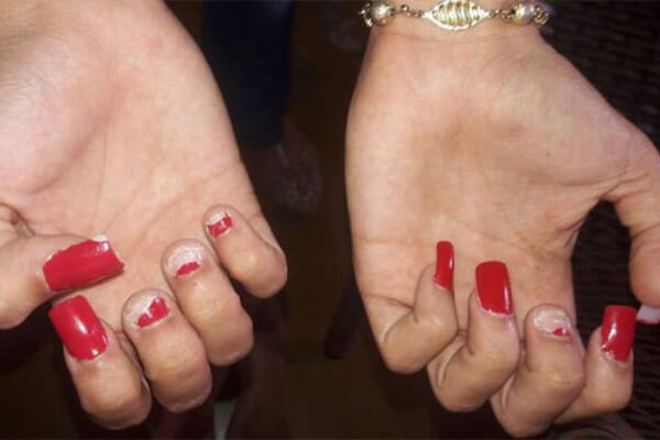 Marido-arranca-unhas-da-esposa-em-crise-de-ciúmes-em-MT