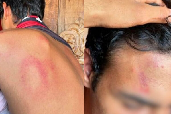 Mãe-de-adolescente-agredido-durante-abordagem-denúncia-PMs-em-MT