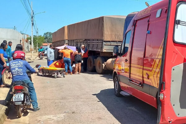 Criança-de-8-anos-sofre-fratura-exposta-em-acidente