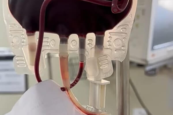 UPA-de-Cáceres-realiza-primeira-transfusão-de-urgência