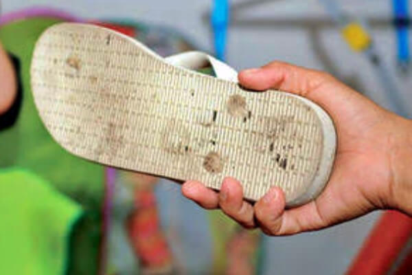 Homem-com-Transtorno-Mental-agride-mulher-a-chineladas