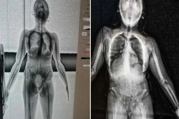 Justiça do Trabalho indefere pedido do Estado e mantém suspensão do body scanner diário