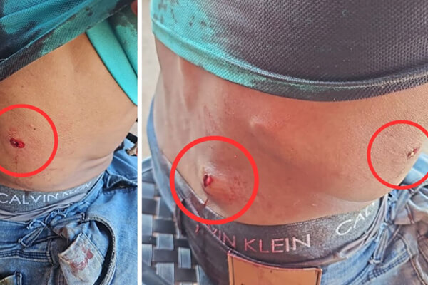 Homem-é-baleado-enquanto-andava-de-bicicleta-em-Cáceres