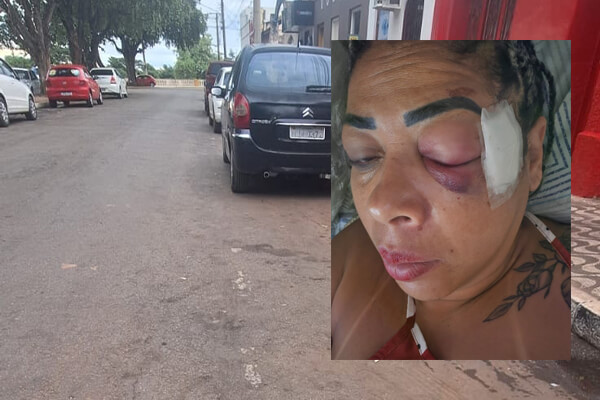 Moradora-de-Cáceres-atropelada